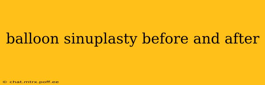 balloon sinuplasty before and after