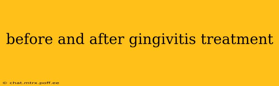before and after gingivitis treatment