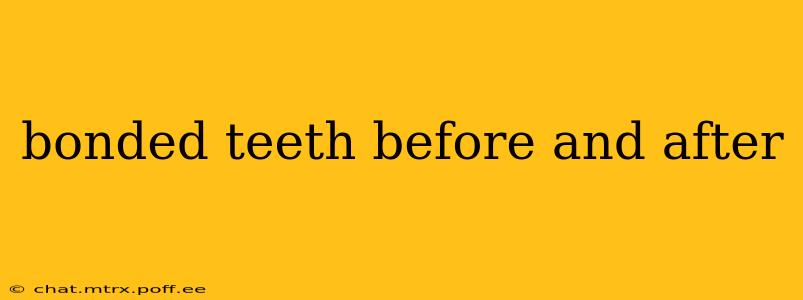 bonded teeth before and after