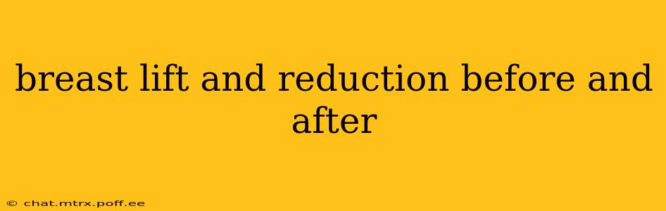 breast lift and reduction before and after