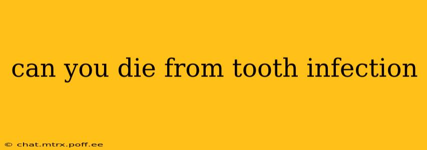 can you die from tooth infection
