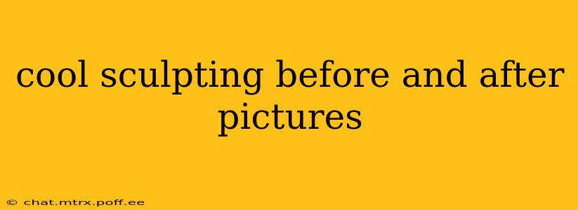 cool sculpting before and after pictures