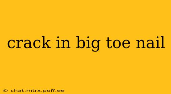 crack in big toe nail