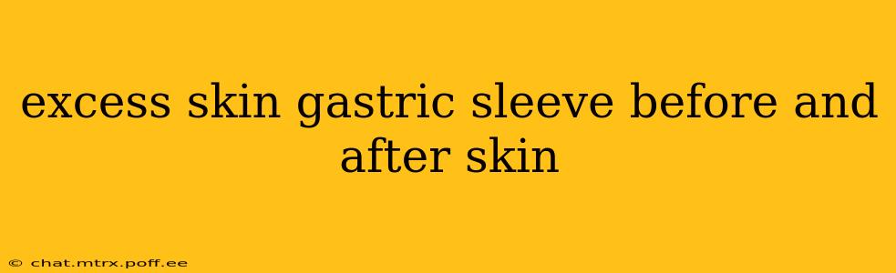 excess skin gastric sleeve before and after skin