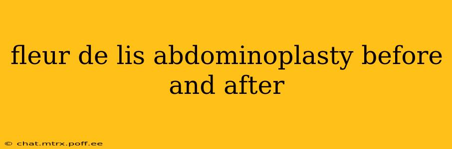 fleur de lis abdominoplasty before and after