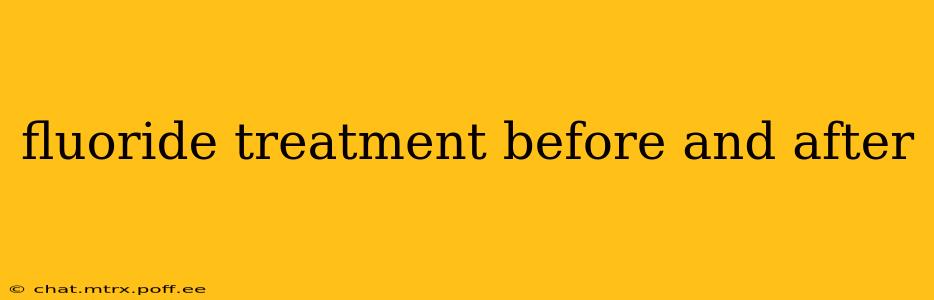 fluoride treatment before and after