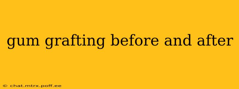 gum grafting before and after