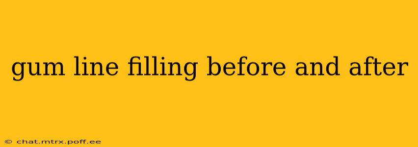 gum line filling before and after