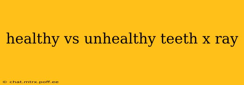 healthy vs unhealthy teeth x ray