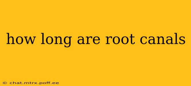 how long are root canals