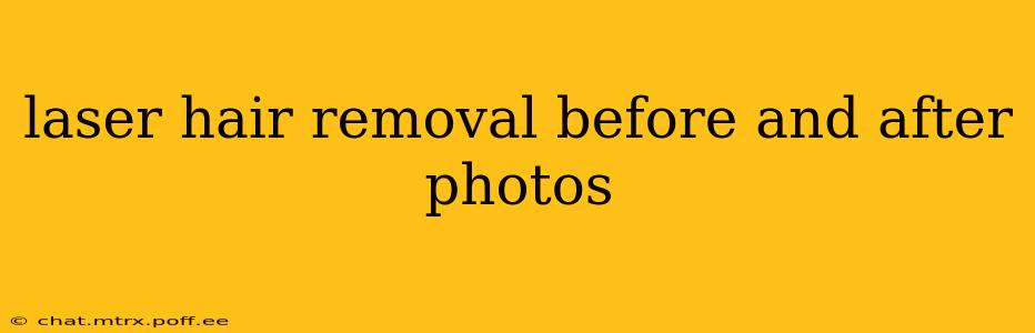 laser hair removal before and after photos