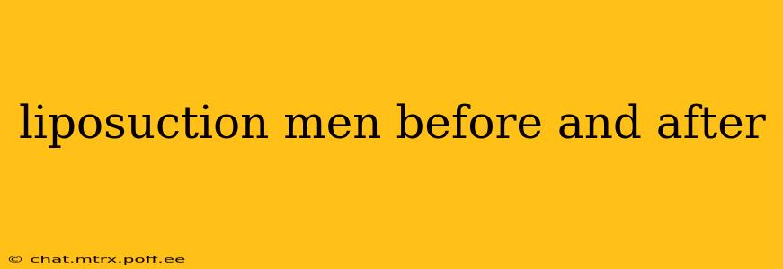 liposuction men before and after