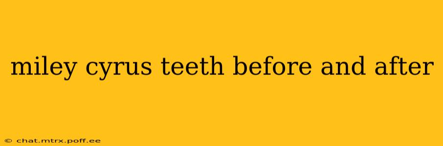 miley cyrus teeth before and after