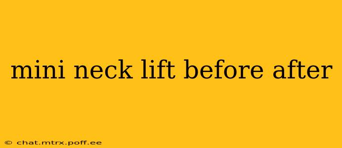 mini neck lift before after