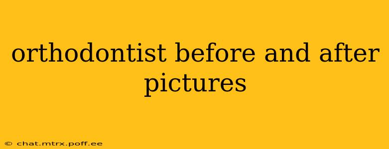 orthodontist before and after pictures
