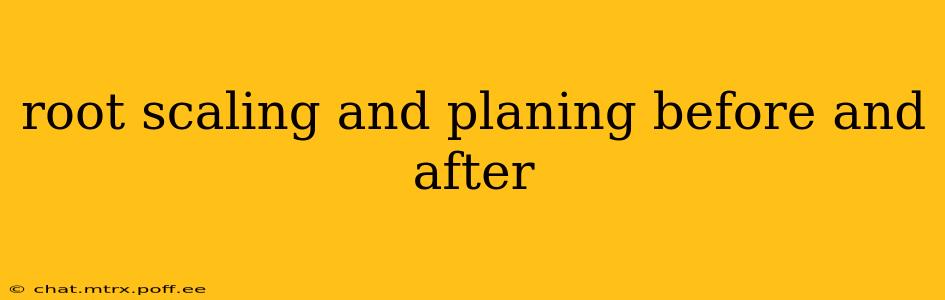 root scaling and planing before and after