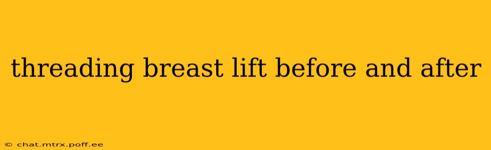 threading breast lift before and after