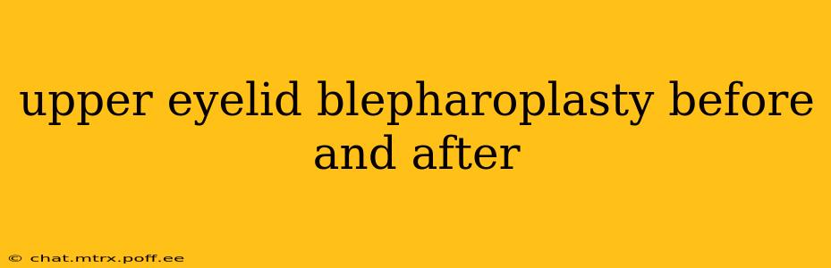 upper eyelid blepharoplasty before and after