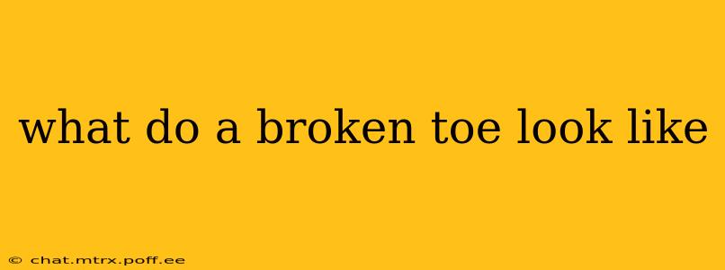 what do a broken toe look like