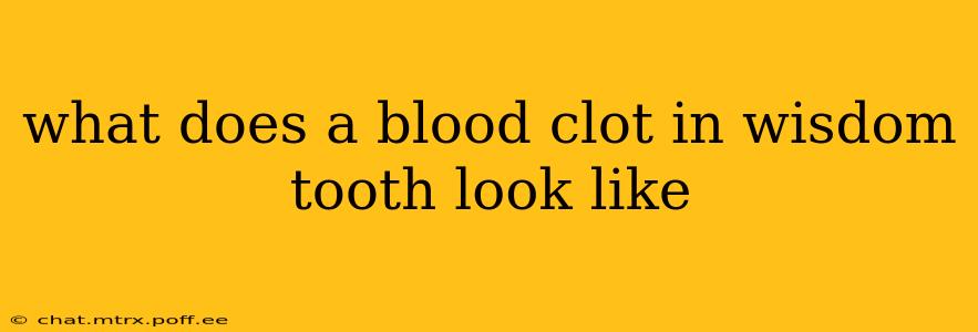 what does a blood clot in wisdom tooth look like