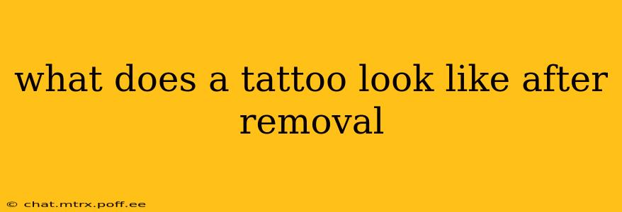 what does a tattoo look like after removal