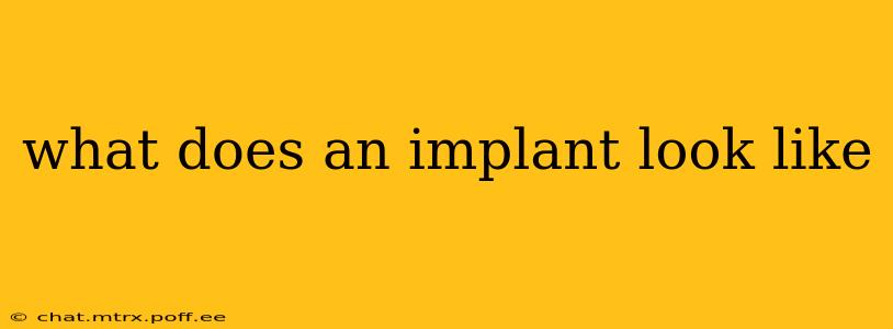 what does an implant look like
