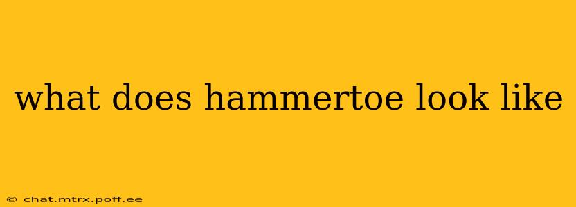 what does hammertoe look like